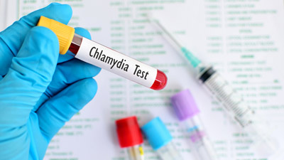How Does Chlamydia Affect Men? Expert Shares Symptoms, Risk Factors, And Treatment